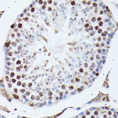 Immunohistochemistry-Paraffin: hnRNP M Antibody - Azide and BSA Free [NBP3-03746]