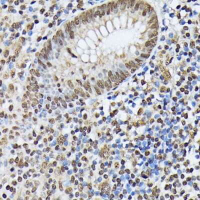 Immunohistochemistry-Paraffin: hnRNP M Antibody - Azide and BSA Free [NBP3-03746]