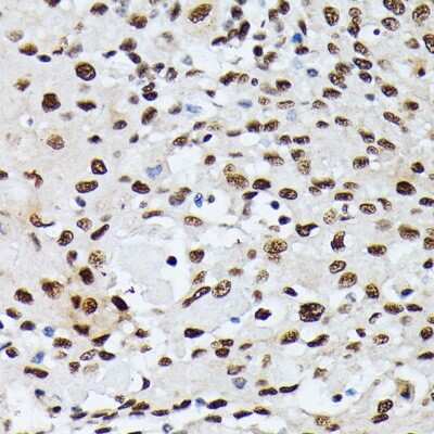 Immunohistochemistry-Paraffin: hnRNP M Antibody - Azide and BSA Free [NBP3-03746]