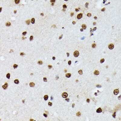 Immunohistochemistry-Paraffin: hnRNP M Antibody - Azide and BSA Free [NBP3-03746]