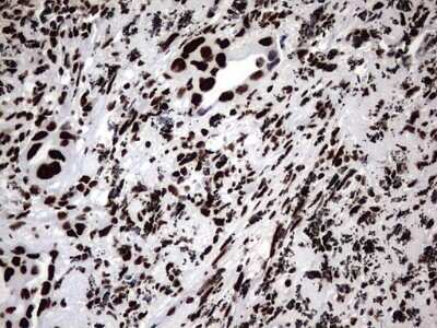 Immunohistochemistry: hnRNP M Antibody (OTI4C9) - Azide and BSA Free [NBP2-71200]