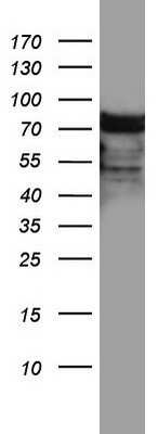 Western Blot: hnRNP M Antibody (OTI4C9)Azide and BSA Free [NBP2-71200]