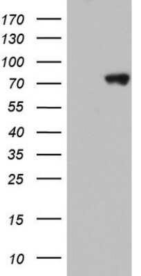 Western Blot: hnRNP M Antibody (OTI4C9)Azide and BSA Free [NBP2-71200]