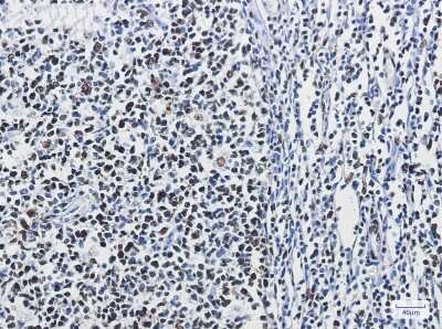 Immunohistochemistry-Paraffin: hnRNP M Antibody (S06-3B1) [NBP3-15042]