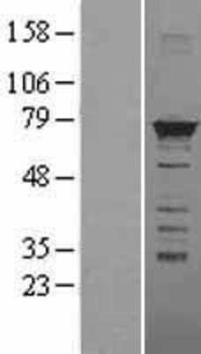 Western Blot: hnRNP M Overexpression Lysate [NBL1-11650]