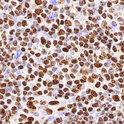 Immunohistochemistry-Paraffin: hnRNP M1-M4 Antibody (1D8) [NB200-314]