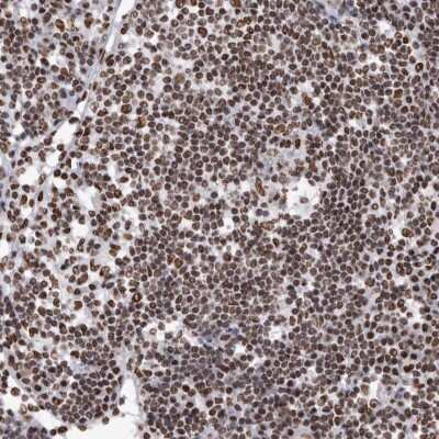Immunohistochemistry-Paraffin: hnRNP M1-M4 Antibody [NBP1-84555]