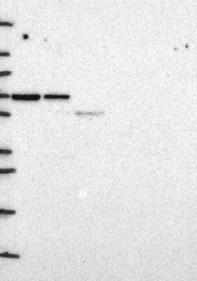 Western Blot: hnRNP-Q Antibody [NBP3-17867]