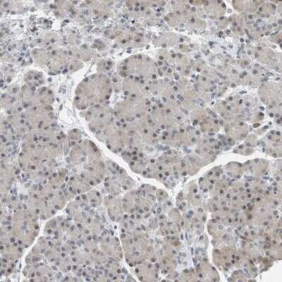 Immunohistochemistry-Paraffin: hnRNP-R Antibody [NBP1-89676]