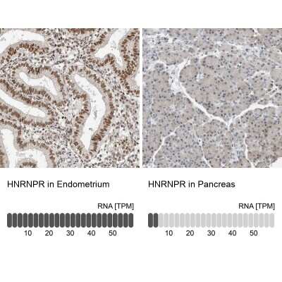 Immunohistochemistry-Paraffin: hnRNP-R Antibody [NBP1-89676]