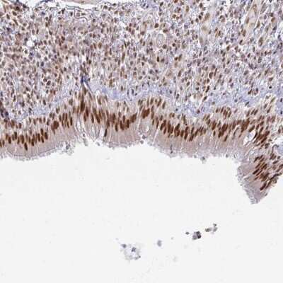 Immunohistochemistry: hnRNP U Antibody [NBP2-48729]
