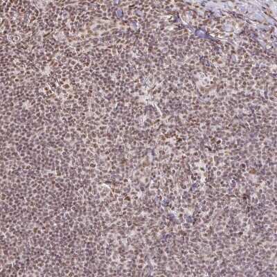 Immunohistochemistry: hnRNP U Antibody [NBP2-48729]