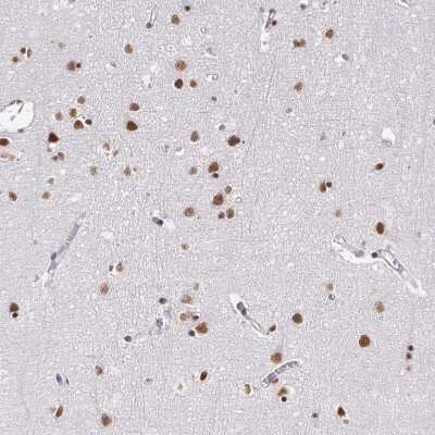 Immunohistochemistry-Paraffin: hnRNP U Antibody [NBP2-48729]