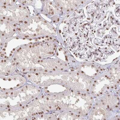 Immunohistochemistry-Paraffin: hnRNP U Antibody [NBP2-48729]