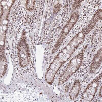 Immunohistochemistry-Paraffin: hnRNP U Antibody [NBP2-48729]