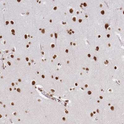Immunohistochemistry-Paraffin: hnRNP U Antibody [NBP2-49290]