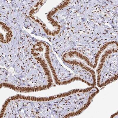 Immunohistochemistry-Paraffin: hnRNP U Antibody [NBP2-49290]