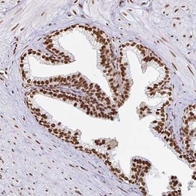 Immunohistochemistry-Paraffin: hnRNP U Antibody [NBP2-49290]
