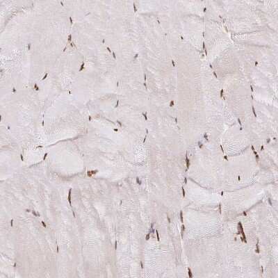 Immunohistochemistry-Paraffin: hnRNP U Antibody [NBP2-49290]