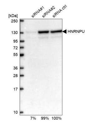 Western Blot: hnRNP U Antibody [NBP2-49290]