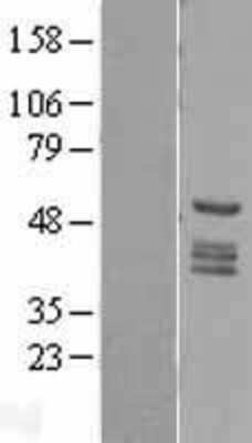 Western Blot: HTRA1/PRSS11 Overexpression Lysate [NBL1-11785]