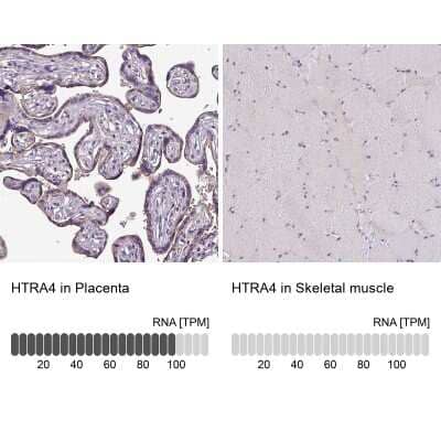 Immunohistochemistry-Paraffin: htrA4 Antibody [NBP2-30882]