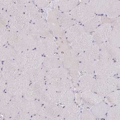 Immunohistochemistry-Paraffin: htrA4 Antibody [NBP2-30882]