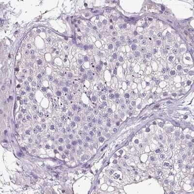 Immunohistochemistry-Paraffin: htrA4 Antibody [NBP2-30882]