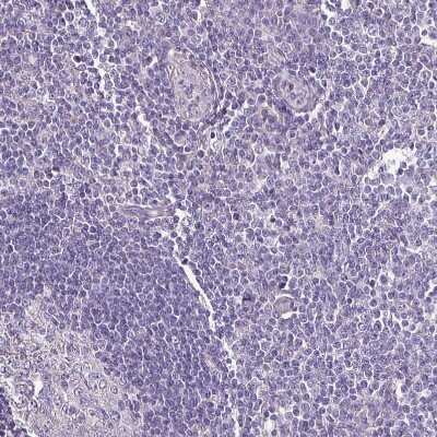 Immunohistochemistry-Paraffin: htrA4 Antibody [NBP2-30882]