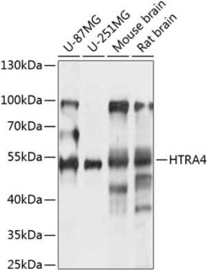 Western Blot: htrA4 AntibodyAzide and BSA Free [NBP3-04960]