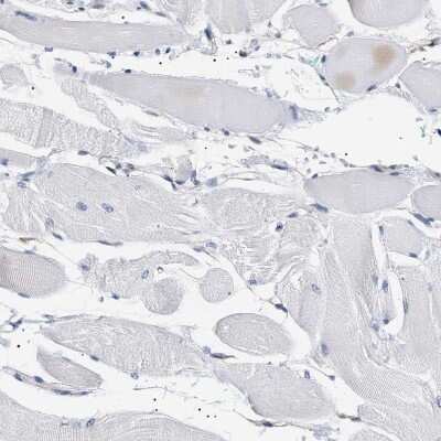 Immunohistochemistry-Paraffin: hydroxysteroid (17-beta) dehydrogenase 11 Antibody [NBP1-90334]
