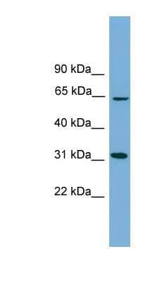 Western Blot: hydroxysteroid (17-beta) dehydrogenase 11 Antibody [NBP1-57081]