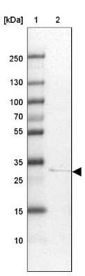 Western Blot: hydroxysteroid (17-beta) dehydrogenase 11 Antibody [NBP1-90334]