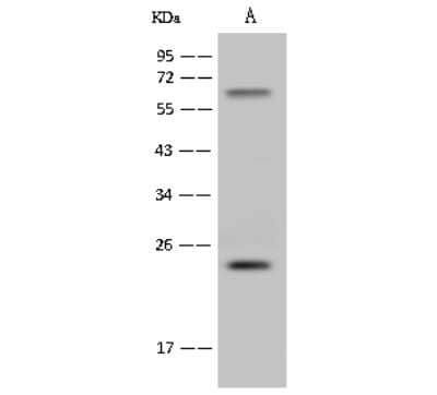 Western Blot: hydroxysteroid (17-beta) dehydrogenase 11 Antibody [NBP2-99361]