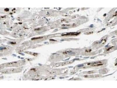 Immunohistochemistry: iASPP Antibody [NBP1-77912]