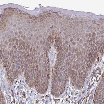 Immunohistochemistry-Paraffin: iASPP Antibody [NBP2-38879]