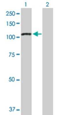 Western Blot: iASPP Antibody [H00010848-D01P]