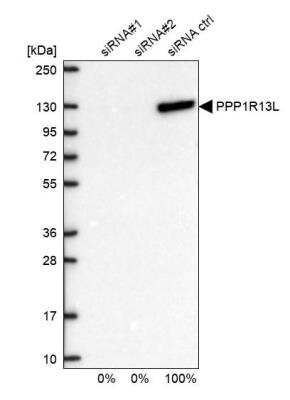 Western Blot: iASPP Antibody [NBP2-48732]