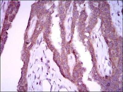 Immunohistochemistry-Paraffin: iNOS Antibody (4E5) - BSA Free [NBP2-22119]