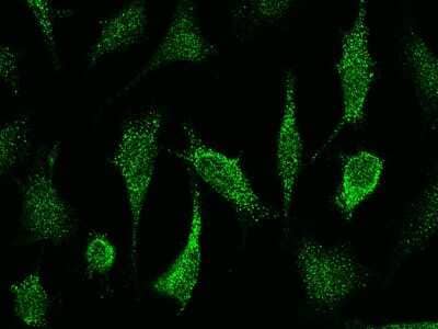 Immunocytochemistry/ Immunofluorescence: iNOS Antibody [NBP2-99091]