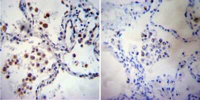 Immunohistochemistry-Paraffin: iNOS Antibody - BSA Free [NB300-605]
