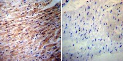 Immunohistochemistry-Paraffin: iNOS Antibody - BSA Free [NB300-605]