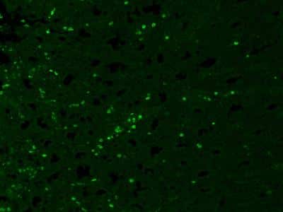 Immunohistochemistry-Paraffin: iNOS Antibody (K13-A) [NBP1-33780]