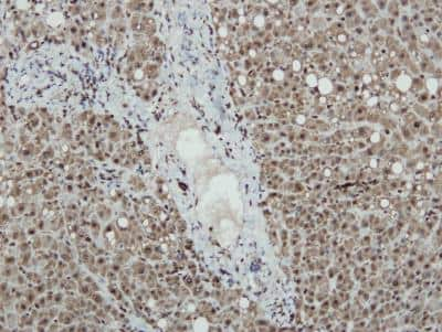 Immunohistochemistry-Paraffin: iNOS Antibody (K13-A) [NBP1-33780]