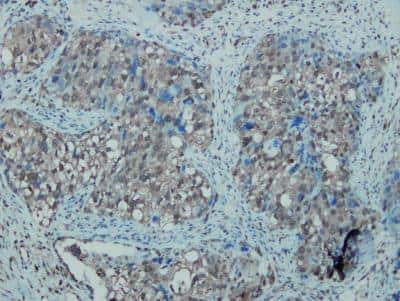 Immunohistochemistry-Paraffin: iNOS Antibody (K13-A) [NBP1-33780]