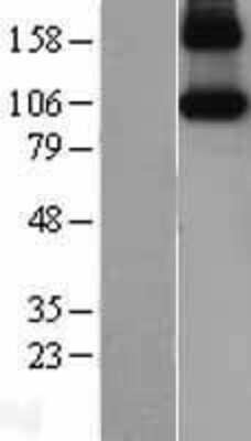 Western Blot: iNOS Overexpression Lysate [NBL1-13721]