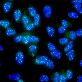 Digoxigenin-labeled ATF6 Antibody in A549 Human Cell Line.