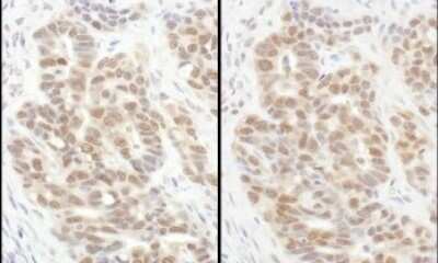 Immunohistochemistry: integrin beta 4 binding protein Antibody [NBP1-52640]