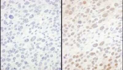 Immunohistochemistry: integrin beta 4 binding protein Antibody [NBP1-52640]