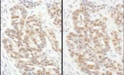 Immunohistochemistry: integrin beta 4 binding protein Antibody [NBP1-52641]